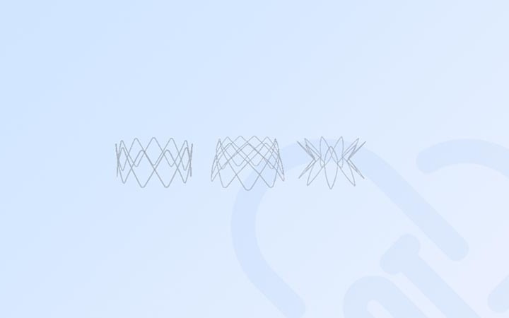 一种鼻窦支架发明专利宣告无效